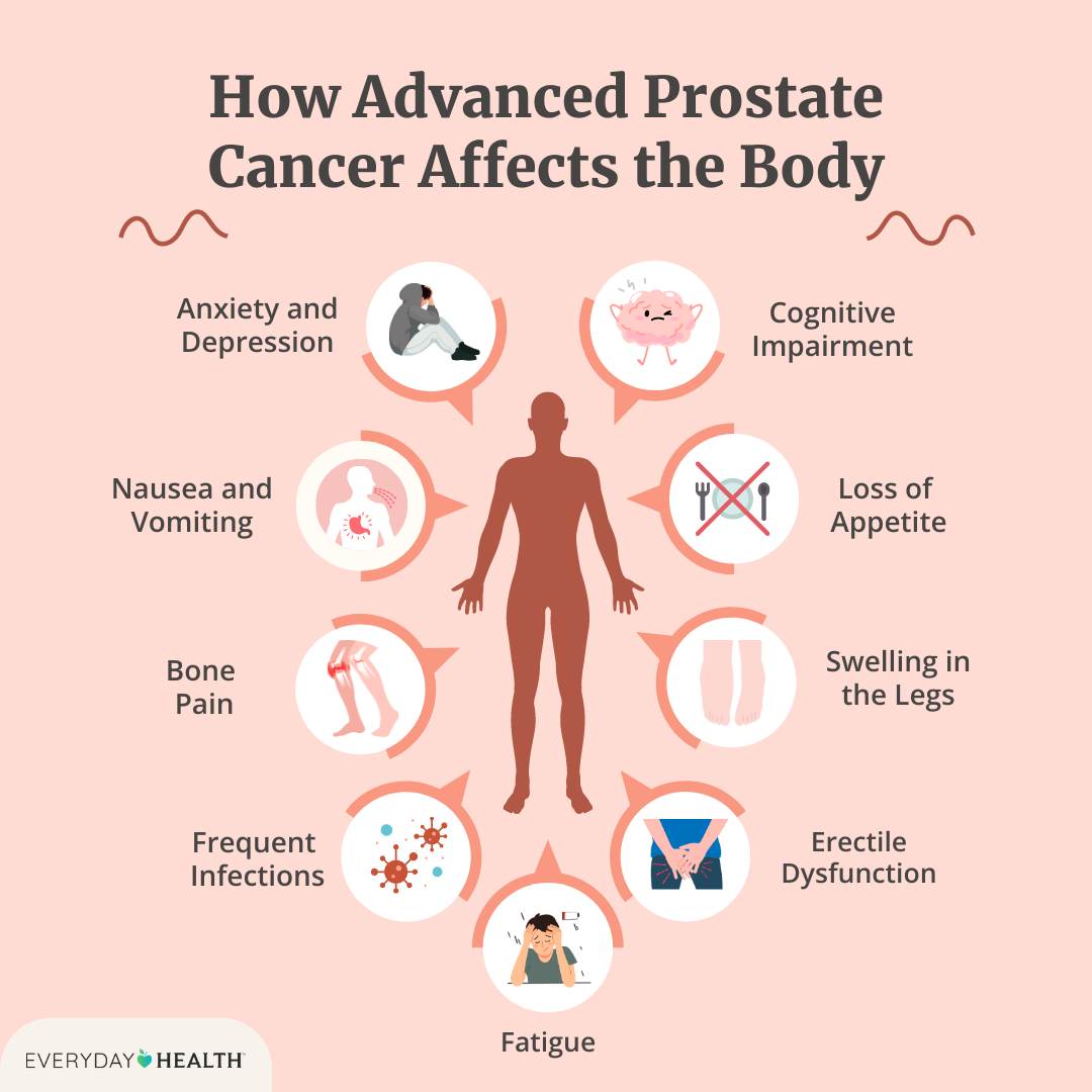 Not testing for prostate cancer could have serious consequences